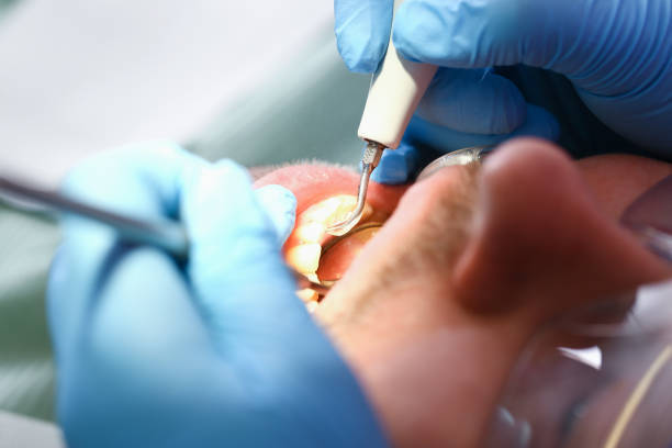 Best Emergency Tooth Extraction  in Waverly, OH